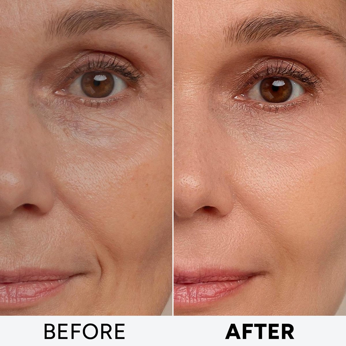 Retinol Cream for Face with Collagen Peptides & Hyaluronic Acid - Anti Aging Wrinkle Cream for Women and Men - Day & Night Facial Moisturizer for Firming, Tightening Neck & Décolleté - görsel 7