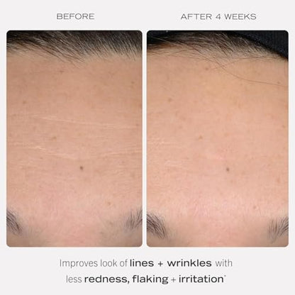 First Aid Beauty 0.3% Retinol Complex Serum with Peptides - Sensitive Skin Retinol for Lines & Wrinkles, Non-Comedogenic, 1 oz Avelisse