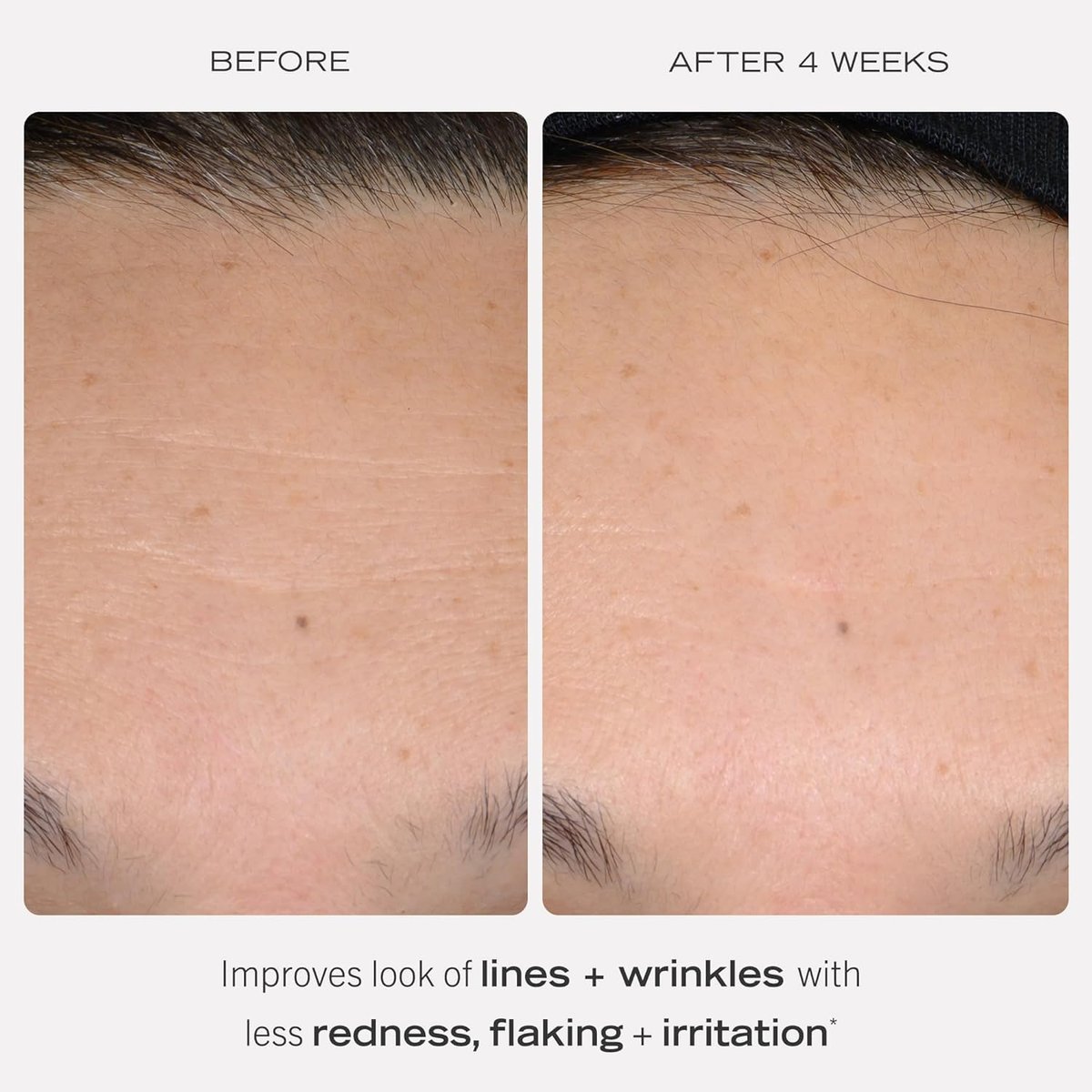 First Aid Beauty 0.3% Retinol Complex Serum with Peptides - Sensitive Skin Retinol for Lines & Wrinkles, Non-Comedogenic, 1 oz Avelisse