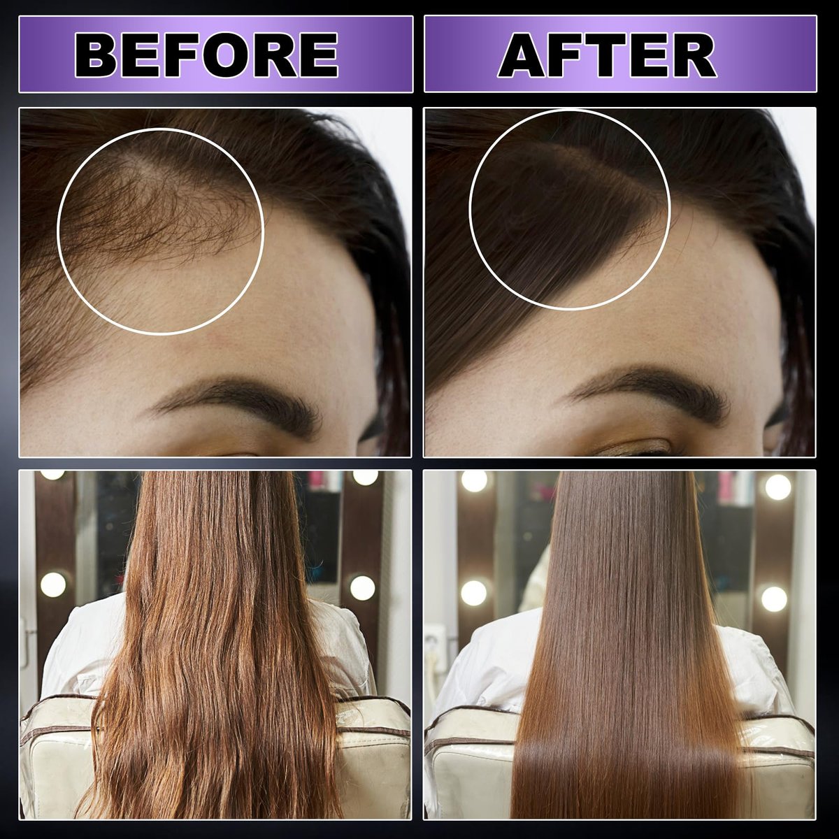 GIFBEA Organic Black Rice Water Hair Growth Serum Spray, 5 Fl Oz, Rosemary Scent, For All Hair Types, With Biotin, Castor Oil, Caffeine, Hair Loss Treatment - görsel 7