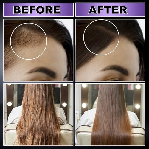GIFBEA Organic Black Rice Water Hair Growth Serum Spray, 5 Fl Oz, Rosemary Scent, For All Hair Types, With Biotin, Castor Oil, Caffeine, Hair Loss Treatment - görsel 8