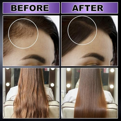 GIFBEA Organic Black Rice Water Hair Growth Serum Spray, 5 Fl Oz, Rosemary Scent, For All Hair Types, With Biotin, Castor Oil, Caffeine, Hair Loss Treatment