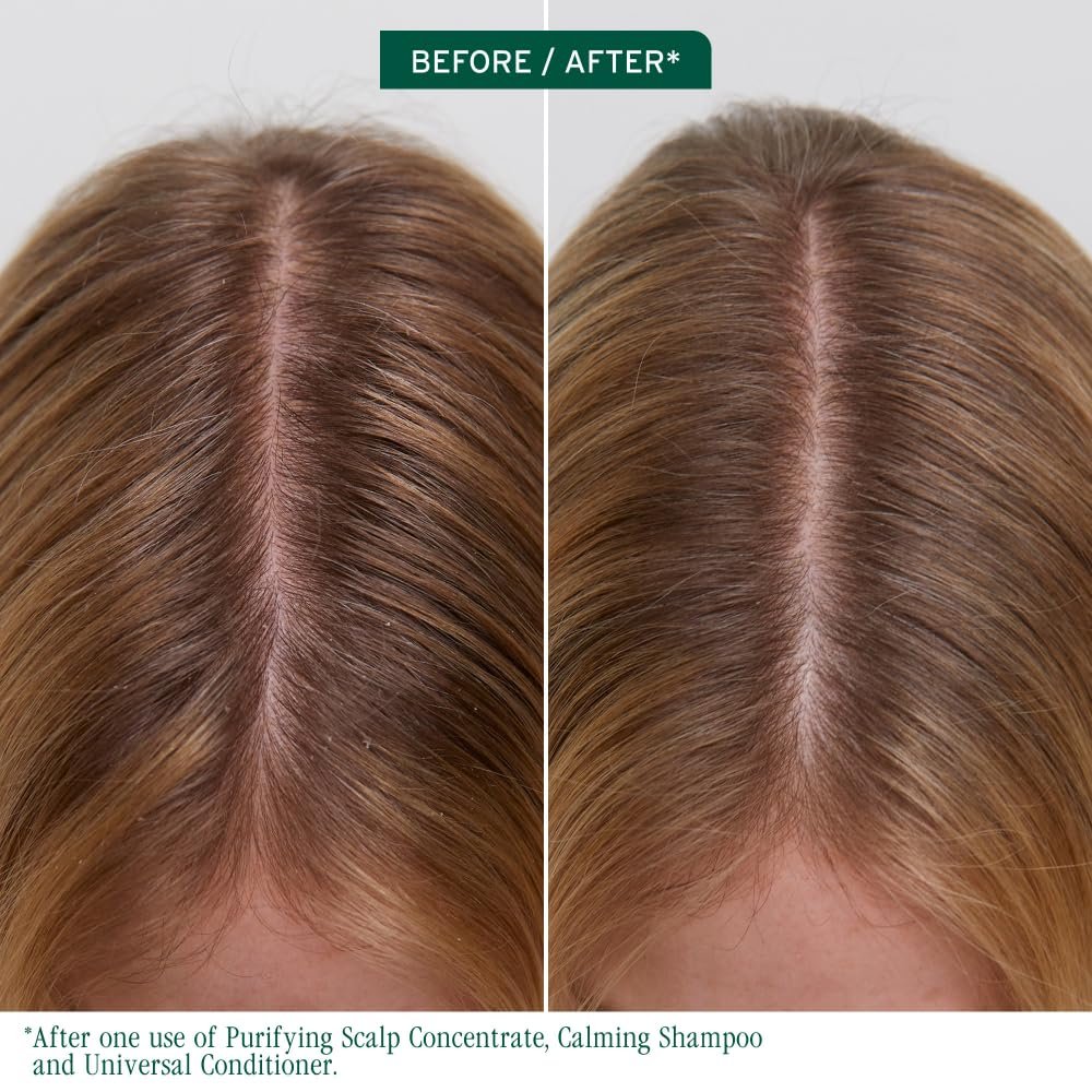 Biolage Scalp Sync Purifying Concentrate - Exfoliating & Clarifying Dry Scalp Treatment with Fermented Tea Blend & Glycolic Acid, 6.8 Fl Oz Avelisse