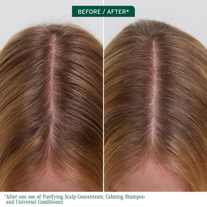 Biolage Scalp Sync Purifying Concentrate - Exfoliating & Clarifying Dry Scalp Treatment with Fermented Tea Blend & Glycolic Acid, 6.8 Fl Oz Avelisse