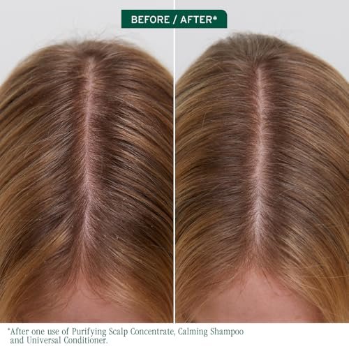 Biolage Scalp Sync Purifying Concentrate - Exfoliating & Clarifying Dry Scalp Treatment with Fermented Tea Blend & Glycolic Acid, 6.8 Fl Oz Avelisse
