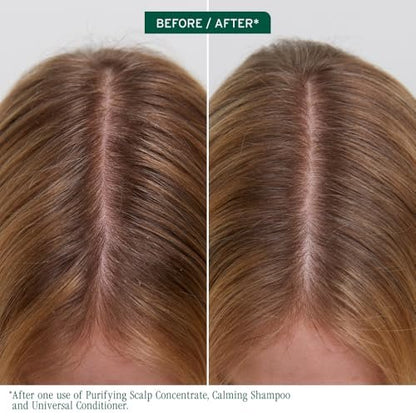 Biolage Scalp Sync Purifying Concentrate - Exfoliating & Clarifying Dry Scalp Treatment with Fermented Tea Blend & Glycolic Acid, 6.8 Fl Oz Avelisse