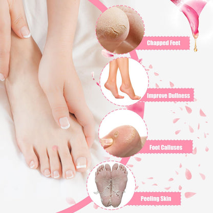 2Pairs Moisturizing Socks - Silicone Gel Socks for Dry Cracked Feet Women - Lotion Socks for Repairing, Softening and Hydrating Feet Avelisse