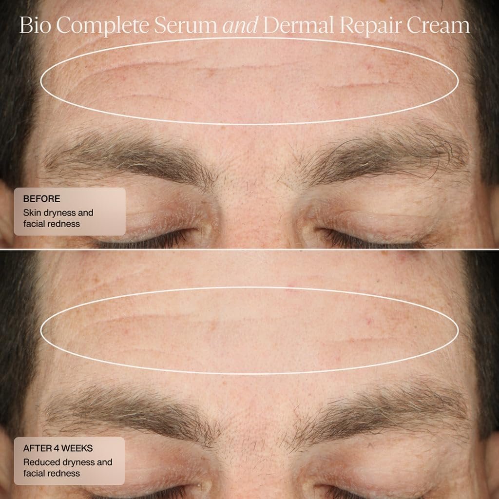 Senté Bio Complete Serum – Gentle Retinoid Serum for Sensitive Skin, Nourishing & Hydrating, Combats Dullness & Signs of Aging, 1 Fl Oz Avelisse