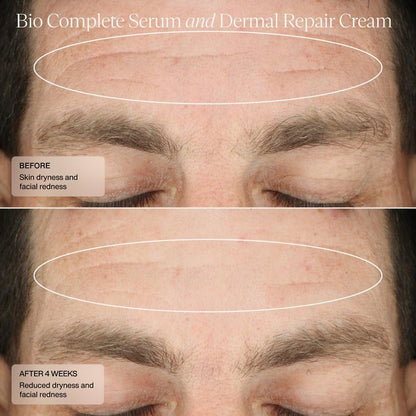 Senté Bio Complete Serum – Gentle Retinoid Serum for Sensitive Skin, Nourishing & Hydrating, Combats Dullness & Signs of Aging, 1 Fl Oz Avelisse