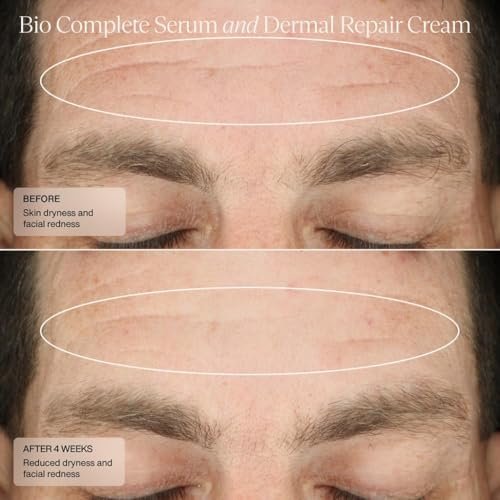 Senté Bio Complete Serum – Gentle Retinoid Serum for Sensitive Skin, Nourishing & Hydrating, Combats Dullness & Signs of Aging, 1 Fl Oz Avelisse