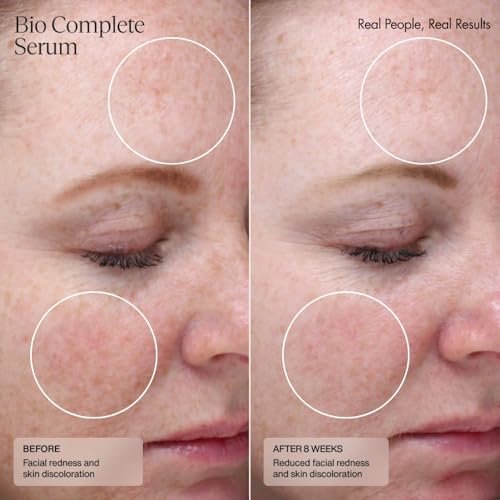 Senté Bio Complete Serum – Gentle Retinoid Serum for Sensitive Skin, Nourishing & Hydrating, Combats Dullness & Signs of Aging, 1 Fl Oz Avelisse