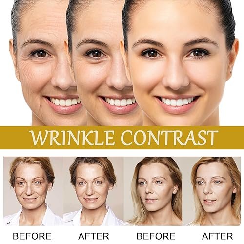 Advanced Bee Venom Serum - Anti-Aging Facial Serum to Refine Fine Lines & Wrinkles, Hydrating Face Essence for Youthful Skin - görsel 12
