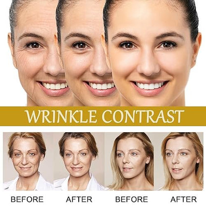 Advanced Bee Venom Serum - Anti-Aging Facial Serum to Refine Fine Lines & Wrinkles, Hydrating Face Essence for Youthful Skin