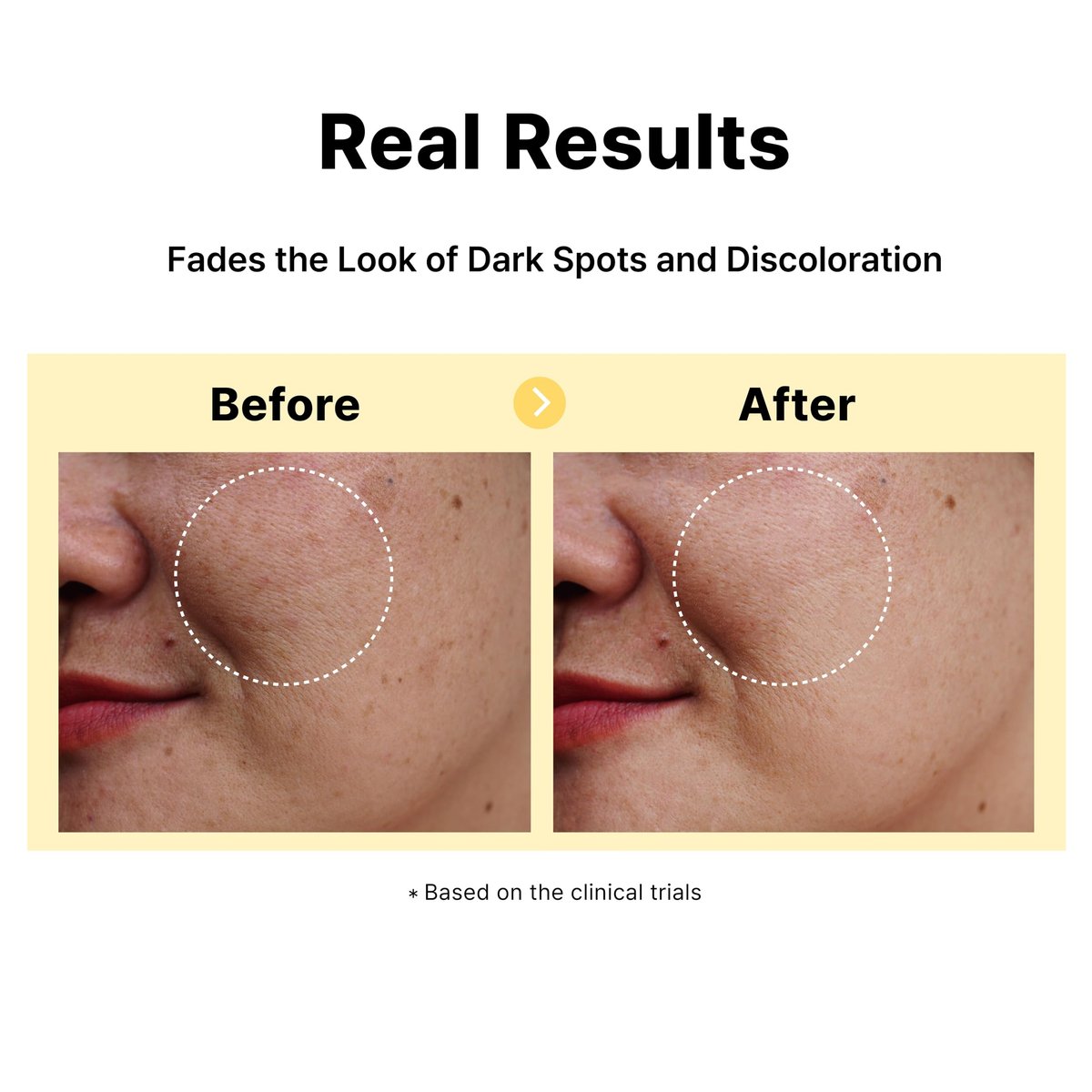 DearMYDEW 5% Tranexamic Acid Serum with 5% Niacinamide & Bakuchiol - Dark Spot Corrector for Hyperpigmentation, Acne Scars, Sun Spots - Korean Skincare, 1 Fl Oz Avelisse