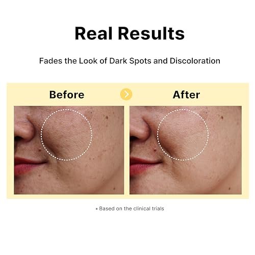 DearMYDEW 5% Tranexamic Acid Serum with 5% Niacinamide & Bakuchiol - Dark Spot Corrector for Hyperpigmentation, Acne Scars, Sun Spots - Korean Skincare, 1 Fl Oz Avelisse