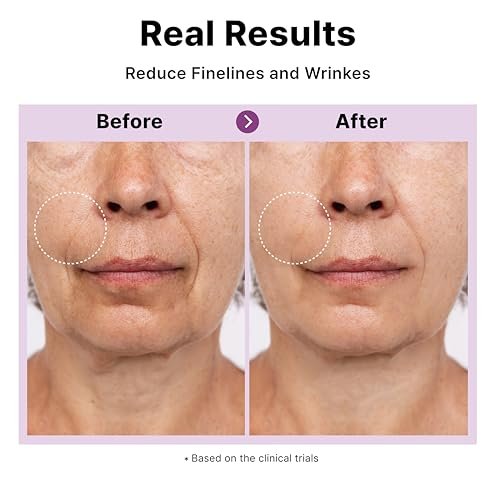 DearMYDEW Multi Peptide Complex Serum - Anti-Aging, Collagen Boost, Wrinkle Repair with Matrixyl 3000, Argireline, Niacinamide, Hyaluronic Acid, Vegan Collagen - Korean Skincare, 1 Fl Oz Avelisse