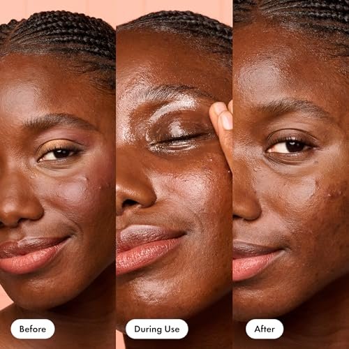 HERO COSMETICS Dissolve Away Daily Cleansing Balm – Gentle Makeup Remover for Sensitive & Acne-Prone Skin, Non-Comedogenic, 2.2 fl oz Avelisse