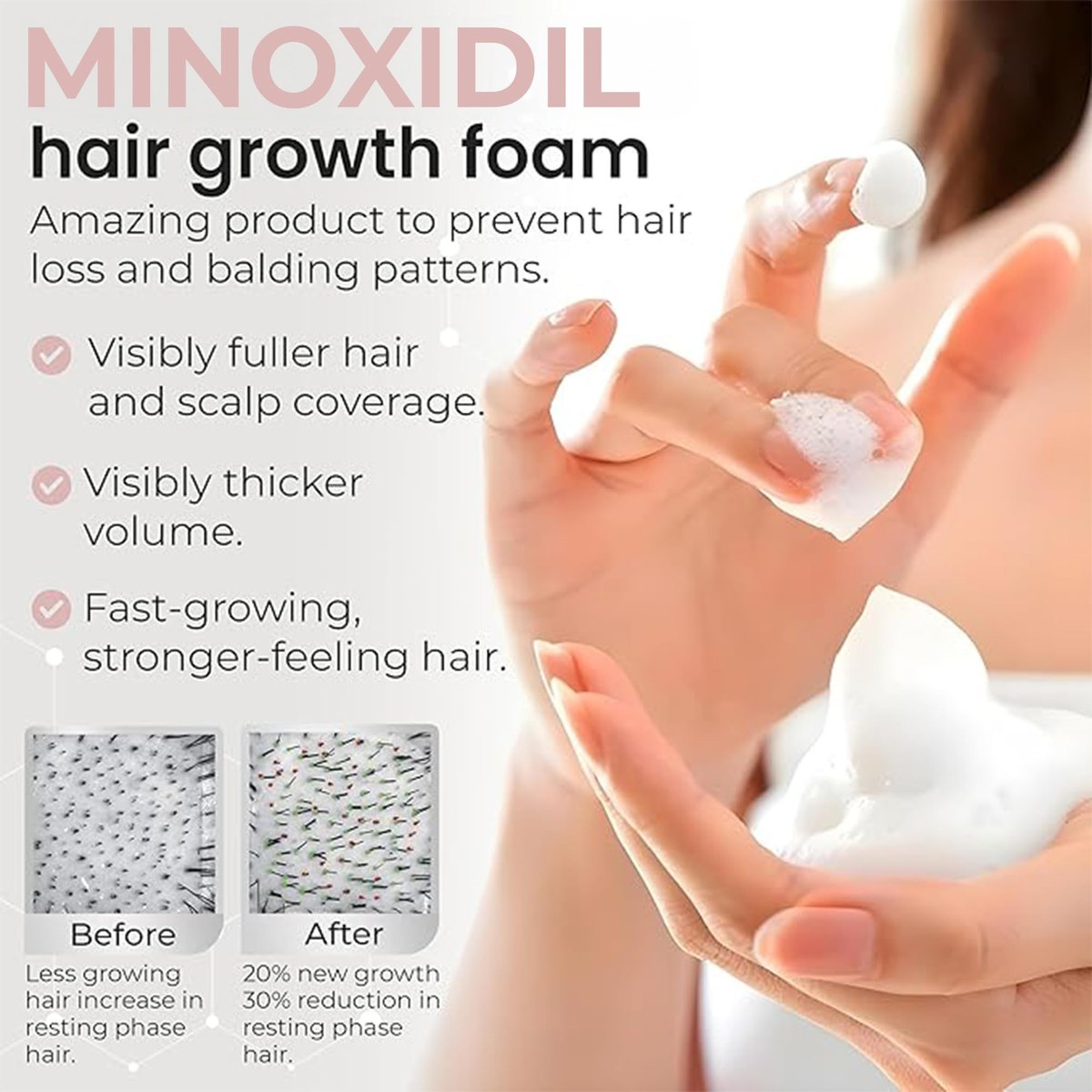 Minoxidil for Women 5% Hair Growth Treatment | Unscented Topical Foam | 3-Month Supply | Dermatologist Recommended Avelisse