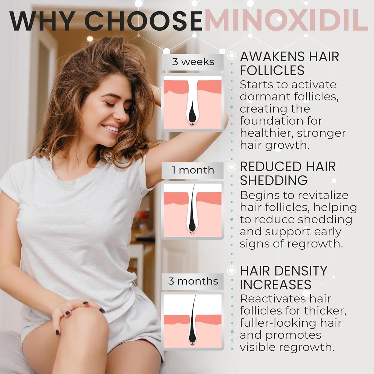 Minoxidil for Women 5% Hair Growth Treatment | Unscented Topical Foam | 3-Month Supply | Dermatologist Recommended Avelisse