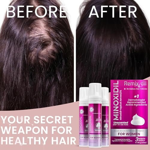 Minoxidil for Women 5% Hair Growth Treatment | Unscented Topical Foam | 3-Month Supply | Dermatologist Recommended Avelisse