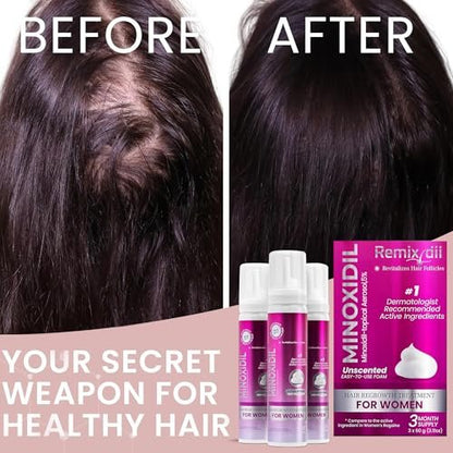 Minoxidil for Women 5% Hair Growth Treatment | Unscented Topical Foam | 3-Month Supply | Dermatologist Recommended Avelisse
