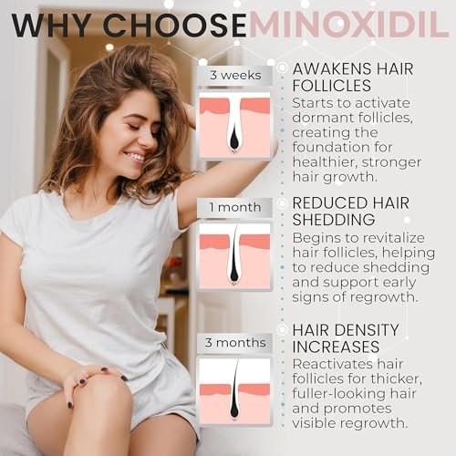 Minoxidil for Women 5% Hair Growth Treatment | Unscented Topical Foam | 3-Month Supply | Dermatologist Recommended Avelisse