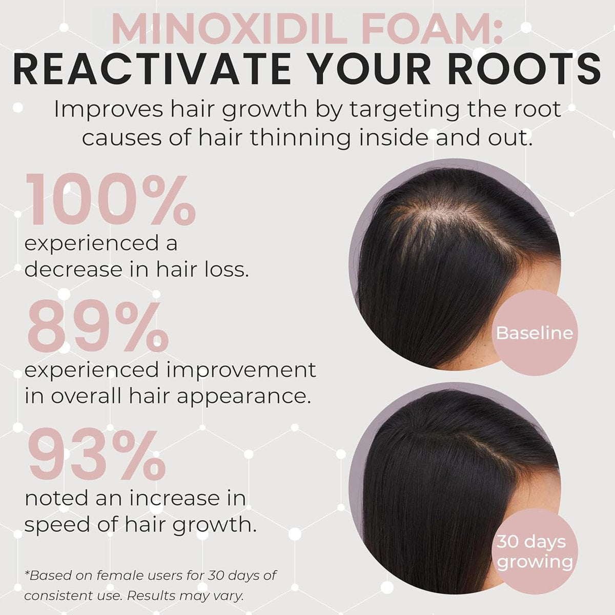 Minoxidil for Women 5% Hair Growth Treatment | Unscented Topical Foam | 3-Month Supply | Dermatologist Recommended Avelisse