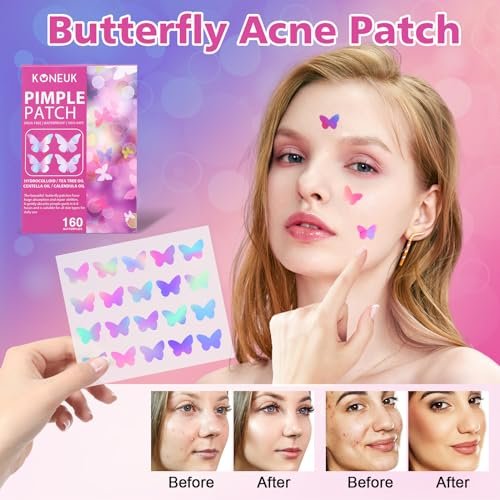 KONEUK Acne Pimple Patches for Face (160 Counts) - Hydrocolloid Acne Patches with Tea Tree Oil and Calendula Extract, Cute Colorful Butterfly Shape Spot Stickers for Skin Care - görsel 6