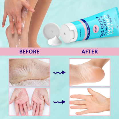 ASDToTio Urea Cream 42% - Intensive Foot Care for Dry Cracked Heels with 2% Salicylic Acid, Tea Tree Oil, Shea Butter & Aloe Vera - 4 oz