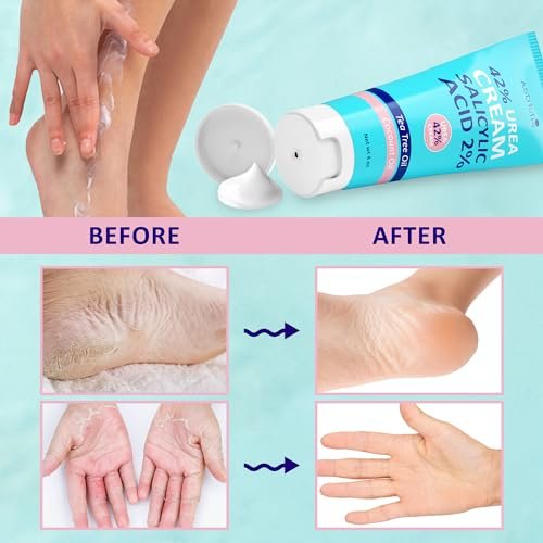 ASDToTio Urea Cream 42% - Intensive Foot Care for Dry Cracked Heels with 2% Salicylic Acid, Tea Tree Oil, Shea Butter & Aloe Vera - 4 oz - görsel 13