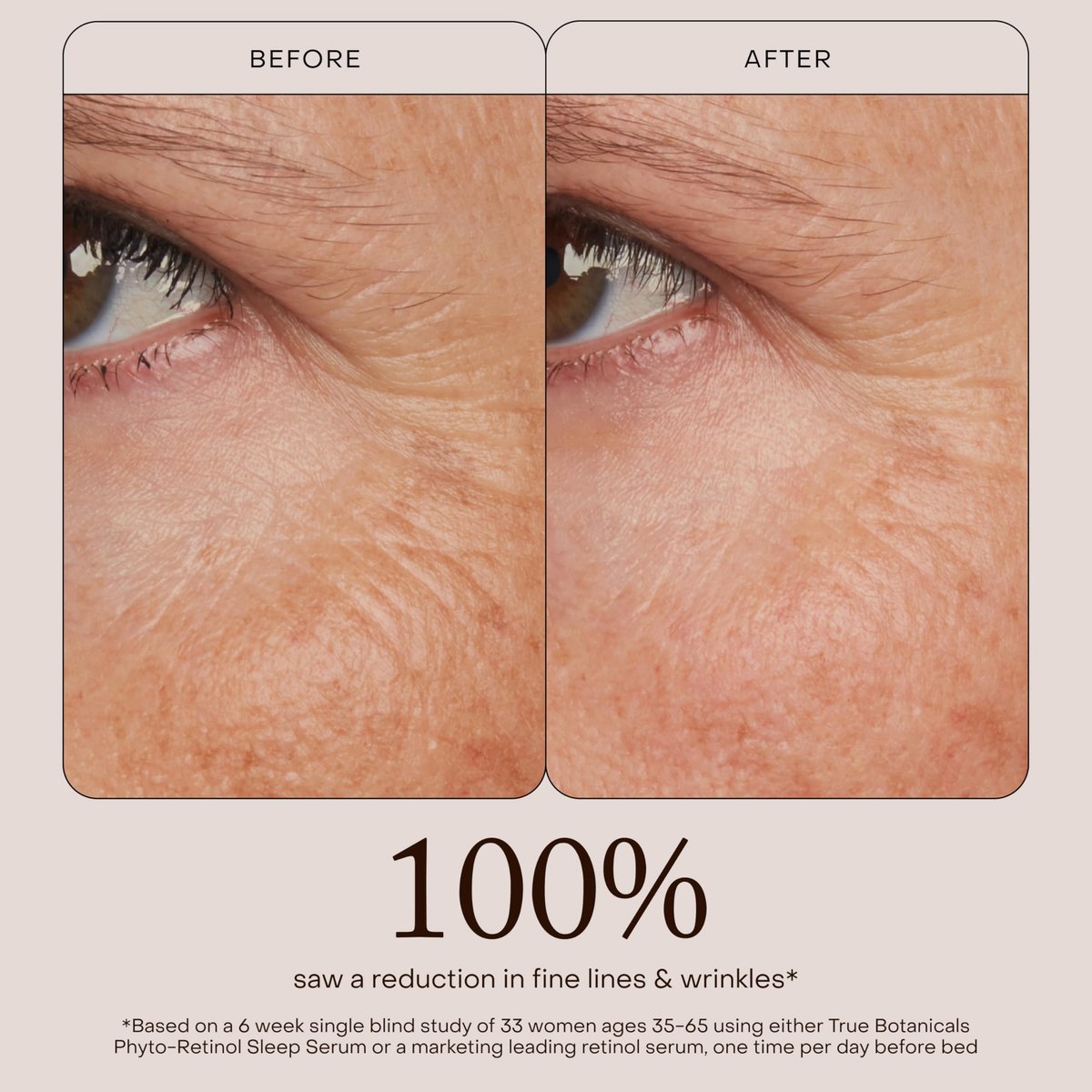 True Botanicals Phyto Retinol Sleep Serum | Nightly Anti-Aging Serum | Retinol Alternative | Targets Fine Lines & Wrinkles | Dermatologist Tested, All Natural, Vegan | 1 fl oz (30 ml) Avelisse