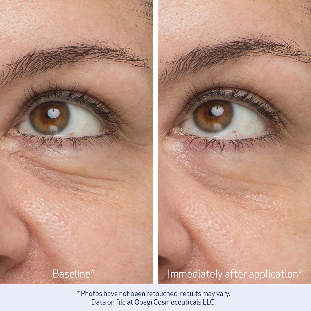 Obagi Daily Hydro-Drops Rejuvenating Eye Gel Cream – Reduce Dark Circles, Brighten, Smooth & Depuff Eyes – 0.5 oz Avelisse