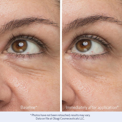 Obagi Daily Hydro-Drops Rejuvenating Eye Gel Cream – Reduce Dark Circles, Brighten, Smooth & Depuff Eyes – 0.5 oz Avelisse