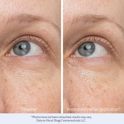 Obagi Daily Hydro-Drops Rejuvenating Eye Gel Cream – Reduce Dark Circles, Brighten, Smooth & Depuff Eyes – 0.5 oz Avelisse