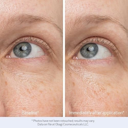 Obagi Daily Hydro-Drops Rejuvenating Eye Gel Cream – Reduce Dark Circles, Brighten, Smooth & Depuff Eyes – 0.5 oz Avelisse