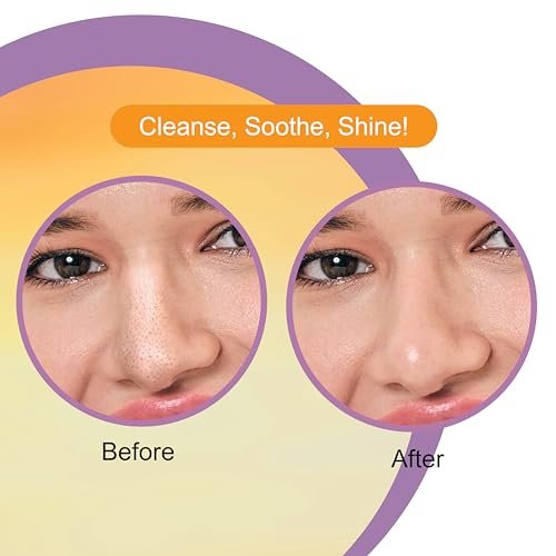 DR.RASHEL Vitamin C Nose Pore Strips – Instant & Painless Blackhead Removal, Deep Purifying, 20 Count (10 Strips + 10 Wipes) - görsel 12
