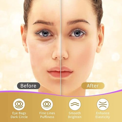 Under Eye Patches 40 Pairs - Gold Eye Mask for Dark Circles, Puffy Eyes, Wrinkles with Hyaluronic Acid, Rose & Aloe Vera - Eye Treatment for Men & Women
