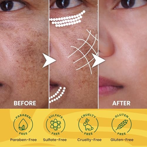 ORGANIC EXTRACT Turmeric Face Mask – Vitamin C Brightening Clay Mask for Face, 4.2 fl oz / 120g – Reduces Dark Spots, Deep Cleansing with Honey, Jojoba Oil, Aloe Vera - görsel 14