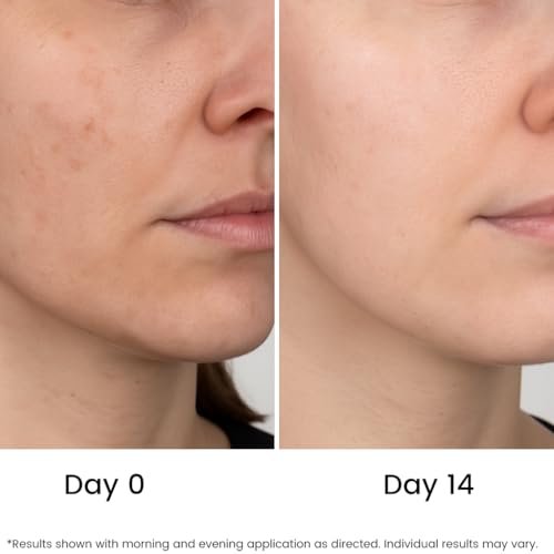 All Natural Pure 20% Vitamin C Serum + 6 Active Boosters for Dark Spots, Wrinkles, Brightening, Hydrating, Even Tone & Healthy Glow with Niacinamide, Hyaluronic Acid, Ferulic Acid, Vitamin E - görsel 8