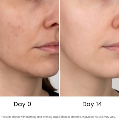 All Natural Pure 20% Vitamin C Serum + 6 Active Boosters for Dark Spots, Wrinkles, Brightening, Hydrating, Even Tone & Healthy Glow with Niacinamide, Hyaluronic Acid, Ferulic Acid, Vitamin E
