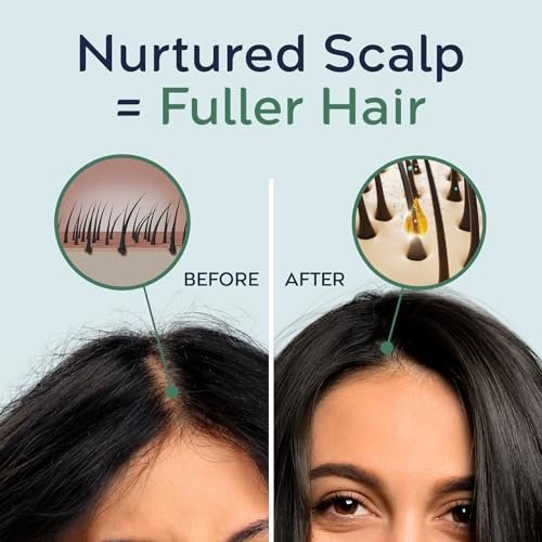 Tree To Tub Rosemary Water Spray for Hair Growth - Fermented Rice Water for Hair Growth, Nourishing Scalp Care, 3.4 Fl Oz Avelisse