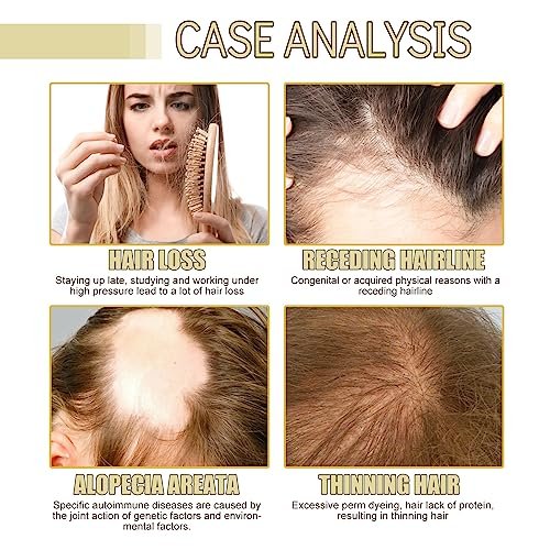 180 ML EELHOE Hair Growth Oil – Natural Rosemary Hair Oil for Dry, Damaged & Thinning Hair (3-Pack) Avelisse