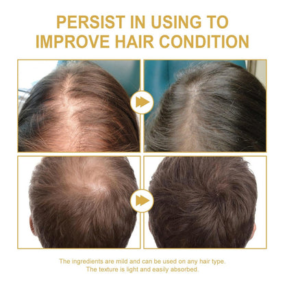 180 ML EELHOE Hair Growth Oil – Natural Rosemary Hair Oil for Dry, Damaged & Thinning Hair (3-Pack) Avelisse