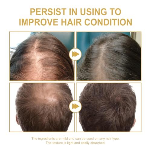 180 ML EELHOE Hair Growth Oil – Natural Rosemary Hair Oil for Dry, Damaged & Thinning Hair (3-Pack) Avelisse