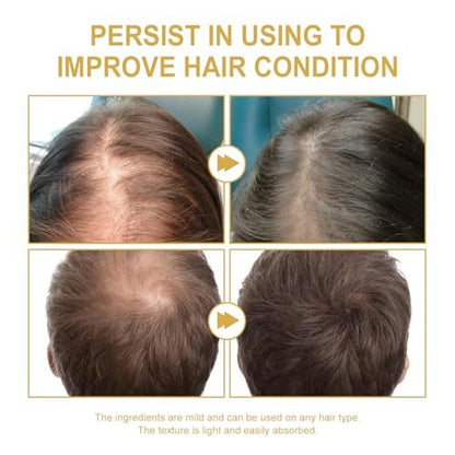 180 ML EELHOE Hair Growth Oil – Natural Rosemary Hair Oil for Dry, Damaged & Thinning Hair (3-Pack) Avelisse