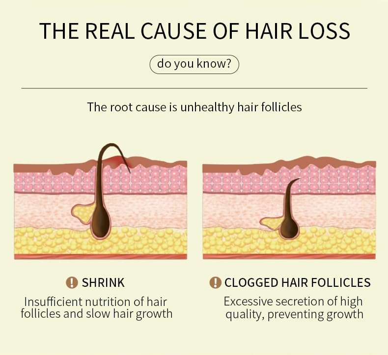 180 ML EELHOE Hair Growth Oil – Natural Rosemary Hair Oil for Dry, Damaged & Thinning Hair (3-Pack) Avelisse