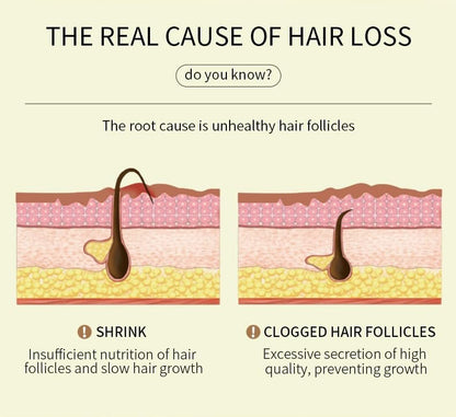 180 ML EELHOE Hair Growth Oil – Natural Rosemary Hair Oil for Dry, Damaged & Thinning Hair (3-Pack) Avelisse