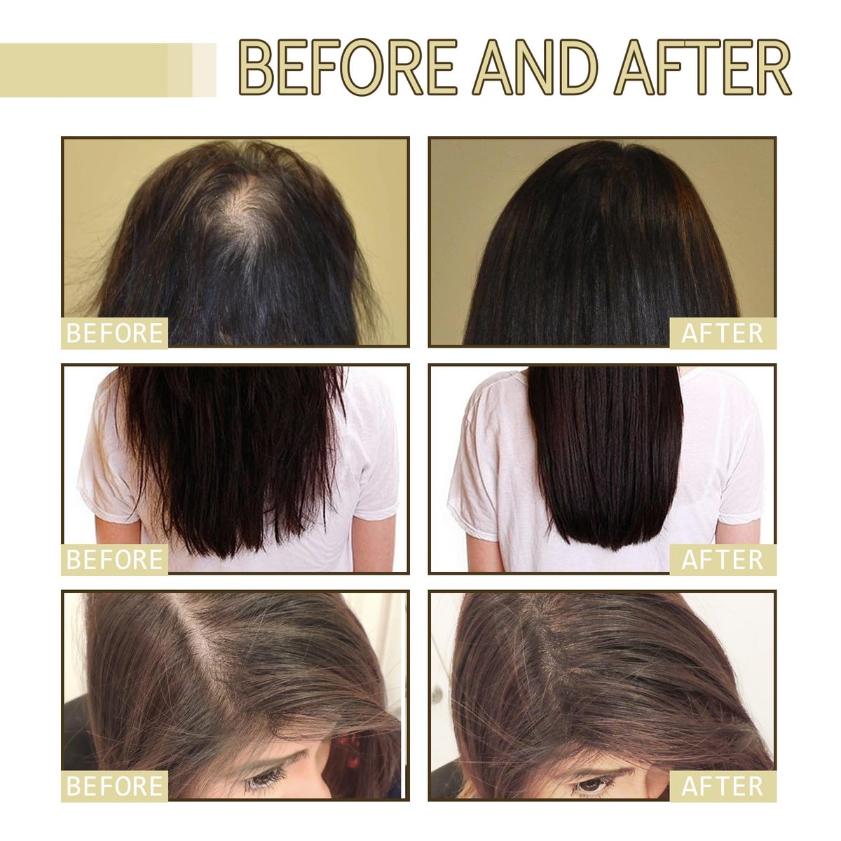 180 ML EELHOE Hair Growth Oil – Natural Rosemary Hair Oil for Dry, Damaged & Thinning Hair (3-Pack) Avelisse