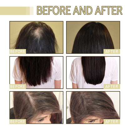 180 ML EELHOE Hair Growth Oil – Natural Rosemary Hair Oil for Dry, Damaged & Thinning Hair (3-Pack) Avelisse