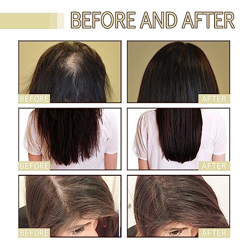 180 ML EELHOE Hair Growth Oil – Natural Rosemary Hair Oil for Dry, Damaged & Thinning Hair (3-Pack) Avelisse